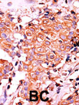 Rabbit Polyclonal Antibody to Phospho-TrkA-Y674/675