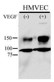 Rabbit Polyclonal Antibody to Phospho-KDR/FLK1(Y996)