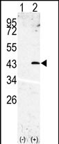 Rabbit Polyclonal Antibody to SPPL3 (N-term)
