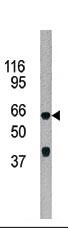 Rabbit Polyclonal Antibody to ADCK5