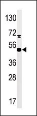 Rabbit Polyclonal Antibody to Phospho-MAPKAPK5(S93)