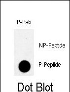 Rabbit Polyclonal Antibody to Phospho-MYT1(T495)