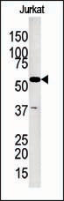 Rabbit Polyclonal Antibody to Glycerol kinase (GPK2)