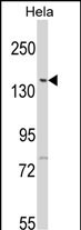 Rabbit Polyclonal Antibody to LMTK2 (N-term)