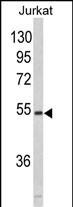 Rabbit Polyclonal Antibody to MFAP1 (N-term)