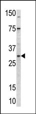 Rabbit Polyclonal Antibody to MRPL24