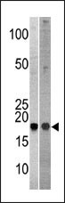 Rabbit Polyclonal Antibody to NCBP2 (N-term)