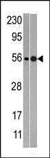 Rabbit Polyclonal Antibody to NMD3