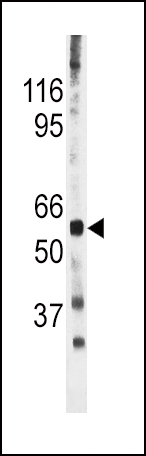 Rabbit Polyclonal Antibody to Phospho-CDC25A(S278)