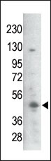 Rabbit Polyclonal Antibody to Bi-Phospho-GSK3B(S21/29)