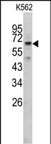 Rabbit Polyclonal Antibody to RIOK1 (N-term)