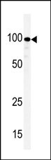 Rabbit Polyclonal Antibody to KSR (N-term E174)
