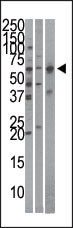 Rabbit Polyclonal Antibody to Importin alpha-3 (KPNA4)Antibody (C-term)