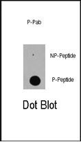 Rabbit Polyclonal Antibody to Phospho-EP300(S89)