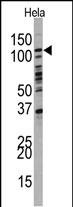 Rabbit Polyclonal Antibody to PI3KC3 (N-term G24)