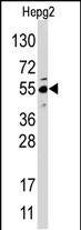 Rabbit Polyclonal Antibody to JMJD4 (N-term)