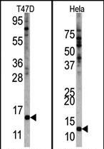 Rabbit Polyclonal Antibody to FAU
