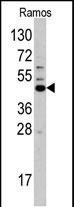 Rabbit Polyclonal Antibody to HS2ST1