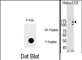 Rabbit Polyclonal Antibody to Phospho-EGFR(Y1069)