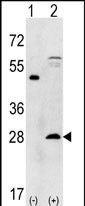 Rabbit Polyclonal Antibody to PSMA5 (N-term)