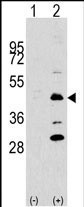 Rabbit Polyclonal Antibody to DPF2 (N-term)