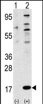 Rabbit Polyclonal Antibody to FAU (N-term)