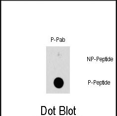 Rabbit Polyclonal Antibody to Phospho-HSPB1(S78)
