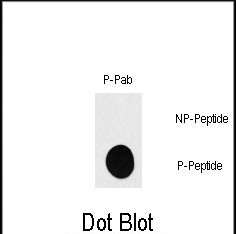 Rabbit Polyclonal Antibody to Phospho-RPS6KB1(S418)