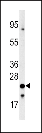 Rabbit Polyclonal Antibody to FXN