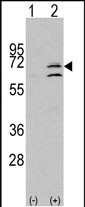 Rabbit Polyclonal Antibody to MAPK15 (N-term)