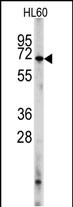 Rabbit Polyclonal Antibody to PDE8A (L572)