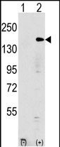Rabbit Polyclonal Antibody to EHMT1 (N-term)
