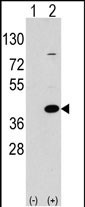 Rabbit Polyclonal Antibody to EPM2A