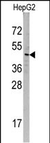 Rabbit Polyclonal Antibody to SNX6 (N-term)