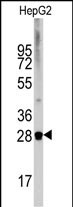 Rabbit Polyclonal Antibody to DRAM (N-term)
