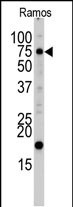 Rabbit Polyclonal Antibody to UVRAG (C-term L555)