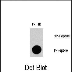 Rabbit Polyclonal Antibody to Phospho-Gab1(Y659)
