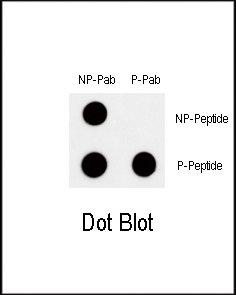 Rabbit Polyclonal Antibody to Phospho-MYC(T58)