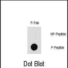 Rabbit Polyclonal Antibody to Phospho-PAK1(T212)
