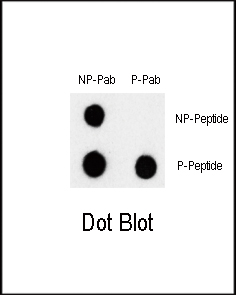 Rabbit Polyclonal Antibody to Phospho-BRAF(S601)