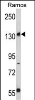 Rabbit Polyclonal Antibody to Rictor (N-term)