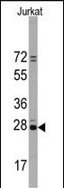 Rabbit Polyclonal Antibody to CD9 (N-term)