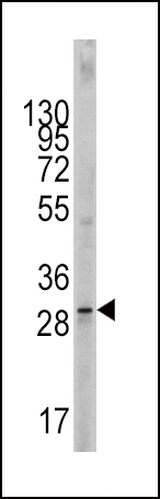 Rabbit Polyclonal Antibody to SCF (KITLG)
