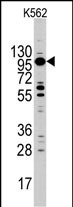 Rabbit Polyclonal Antibody to Myosin 1C (MYO1C)