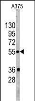 Rabbit Polyclonal Antibody to PIST