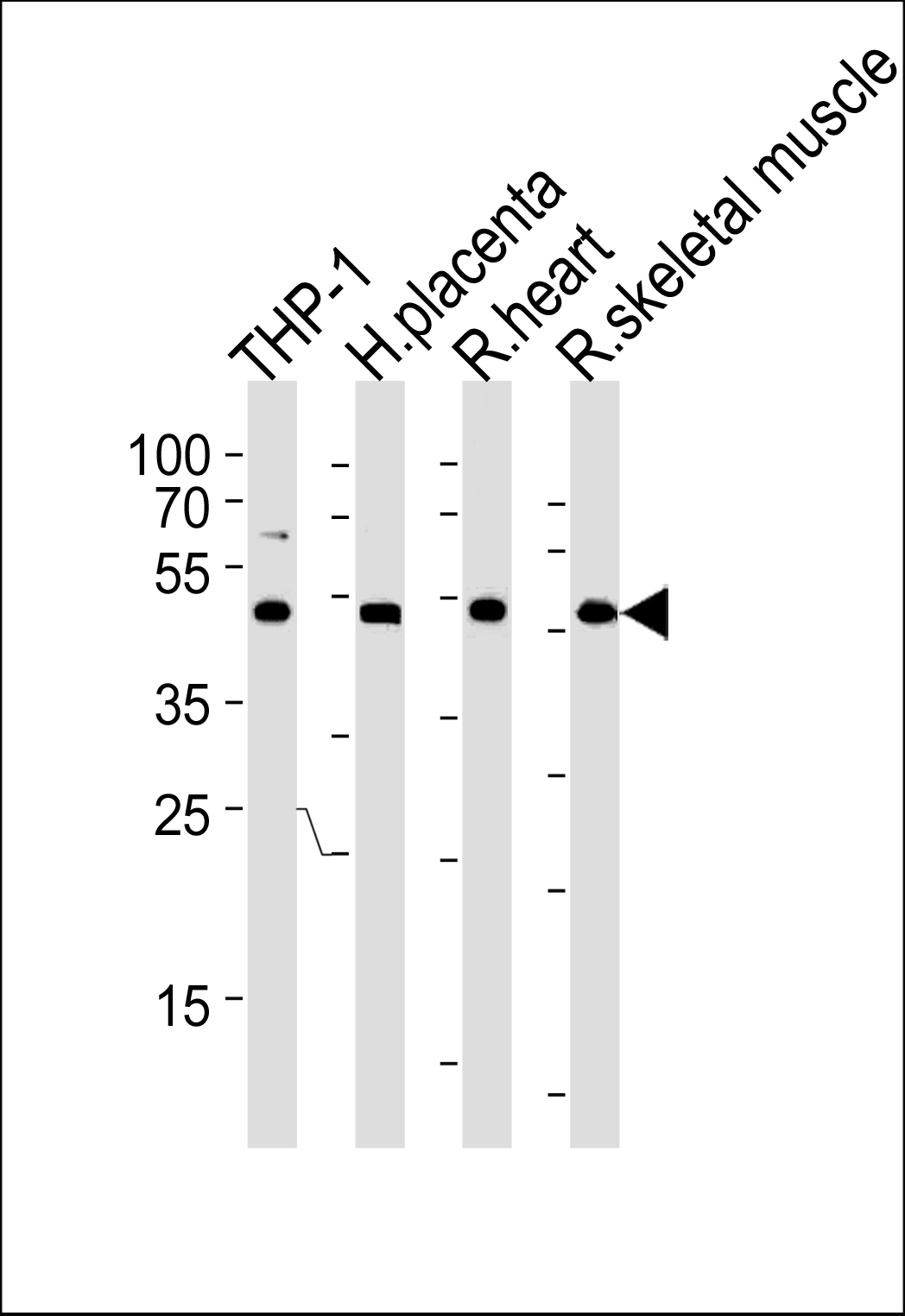 Rabbit Polyclonal Antibody to CIR (N-term)