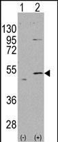 Rabbit Polyclonal Antibody to ALDH5A1 (N-term)