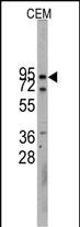 Rabbit Polyclonal Antibody to CDH10 (N-term)