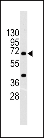 Rabbit Polyclonal Antibody to ABCG2 (BCRP)