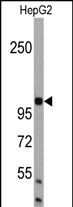 Rabbit Polyclonal Antibody to AMBRA1 (N-term)